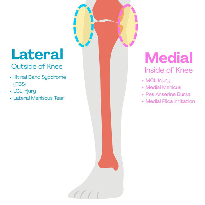 Ossur Unloader Universal OA Knee Brace
